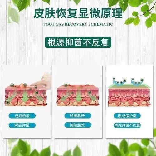 长粉刺不能吃什么