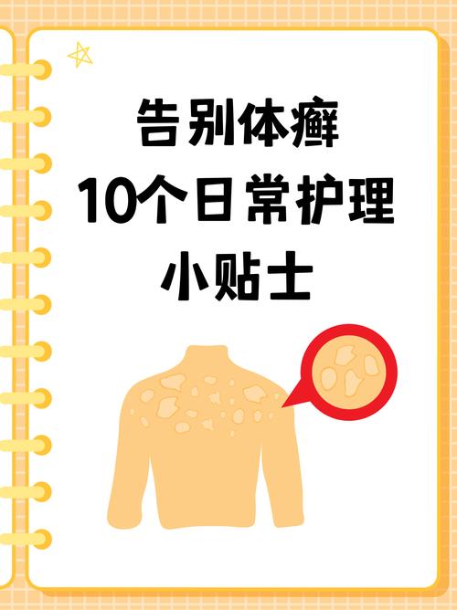 为什么会得体癣
