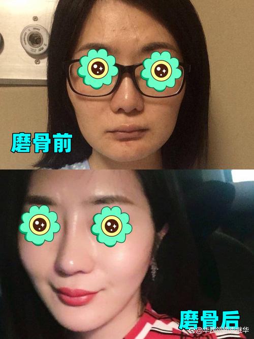 脸宽是为什么