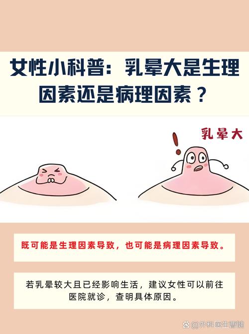 乳晕什么样