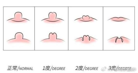 乳晕什么样