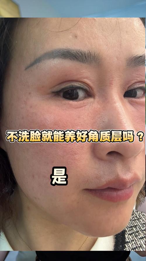 角质什么样