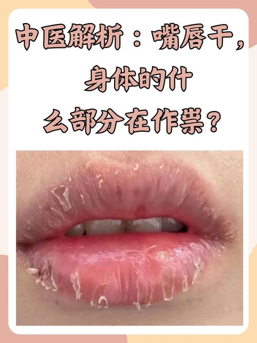 上嘴唇干是什么原因