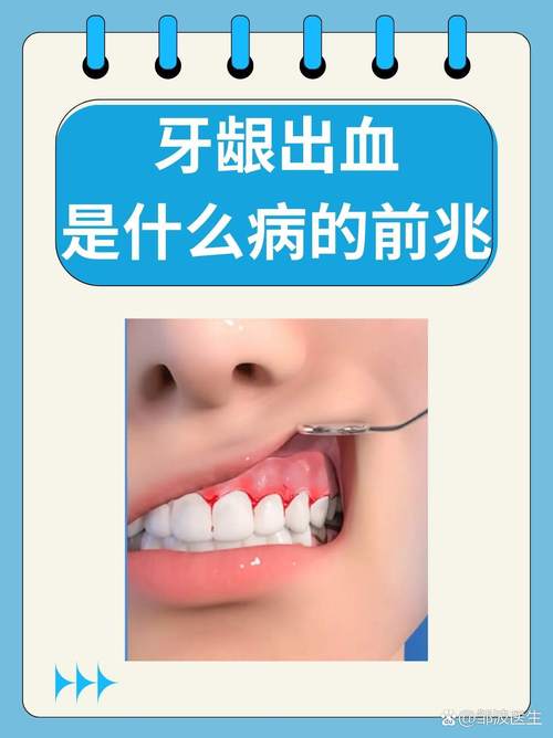 出牙血是什么原因