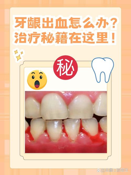 出牙血是什么原因