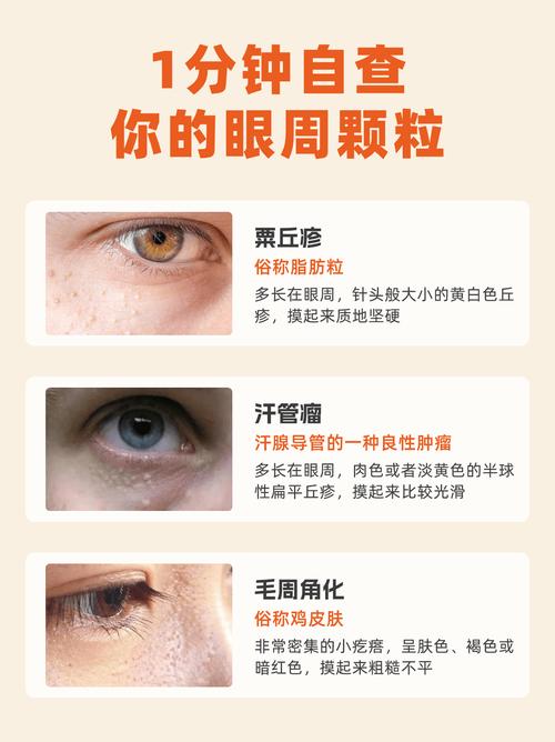为什么眼皮长脂肪粒