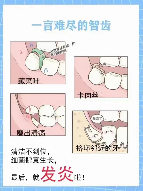 长智齿的原因是什么