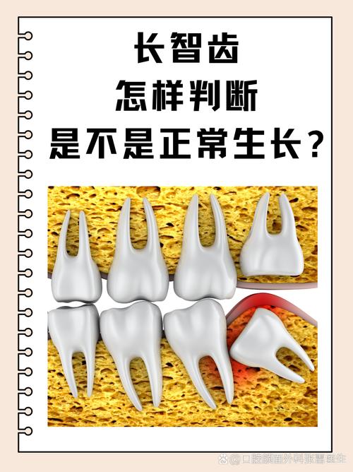 长智齿的原因是什么
