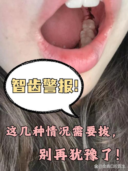 长智齿的原因是什么