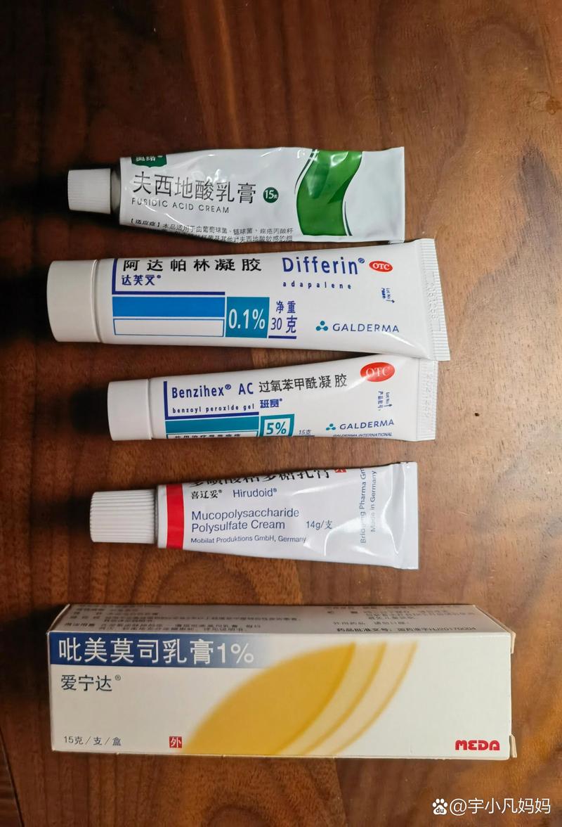 脸上过敏吃什么药好