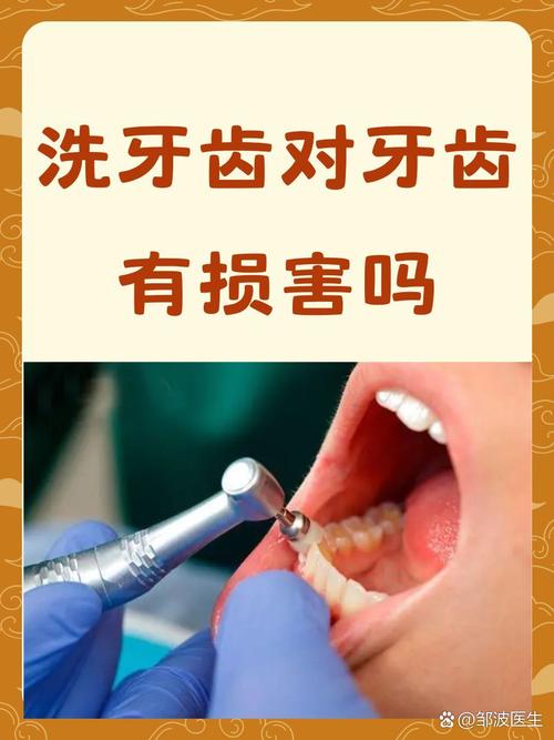 洗牙有什么坏处吗