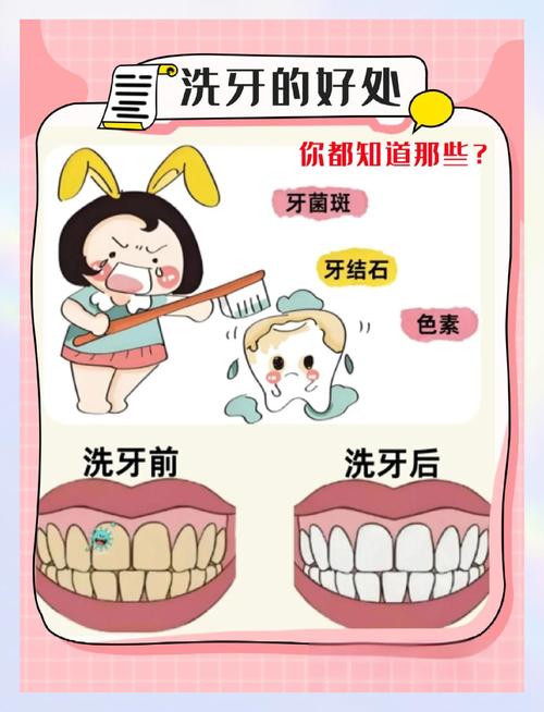 洗牙有什么坏处吗
