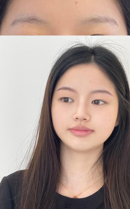 不长眉毛是什么原因