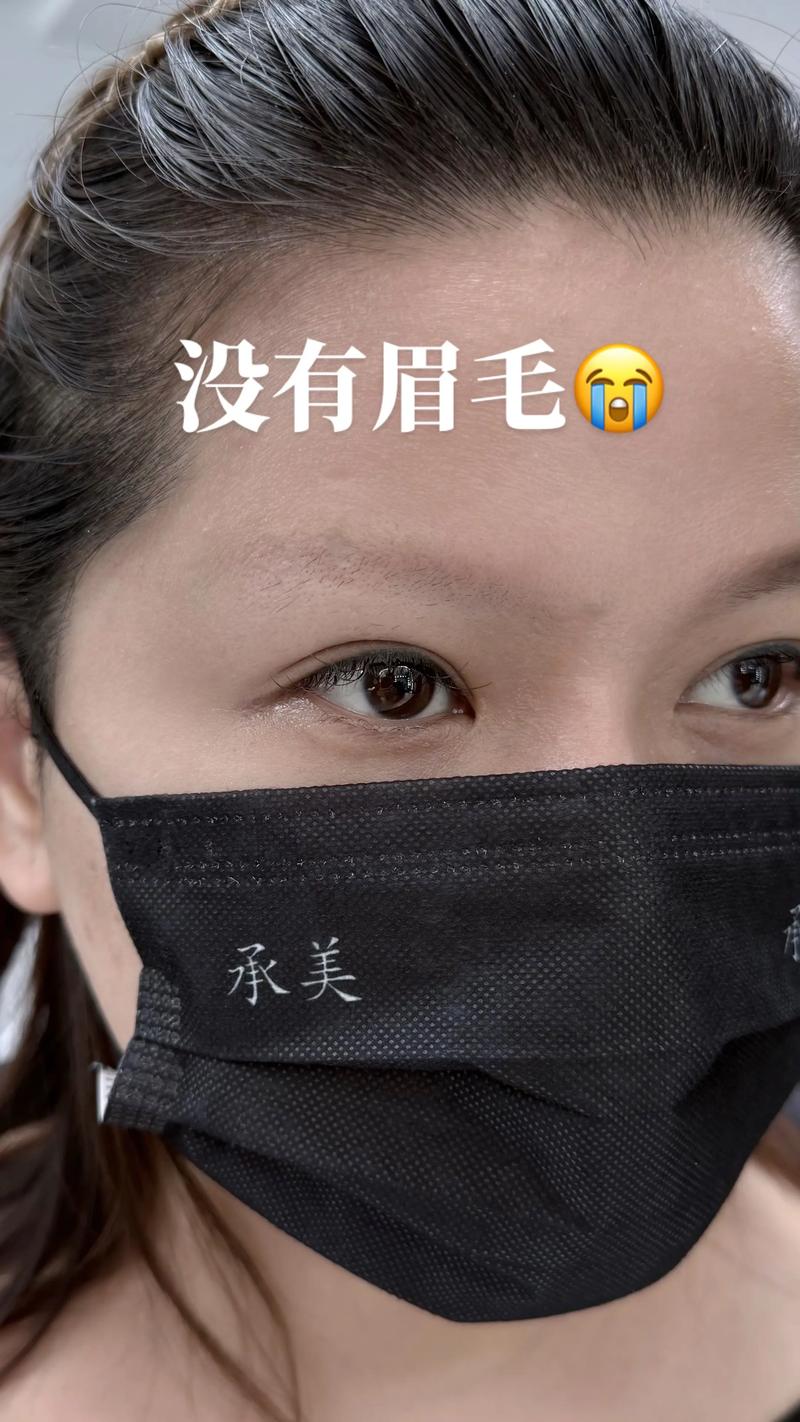 不长眉毛是什么原因