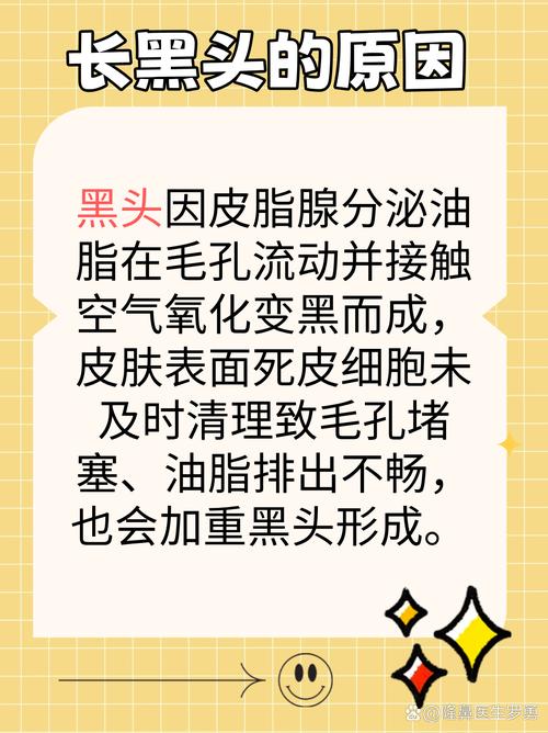为什么鼻子长黑头