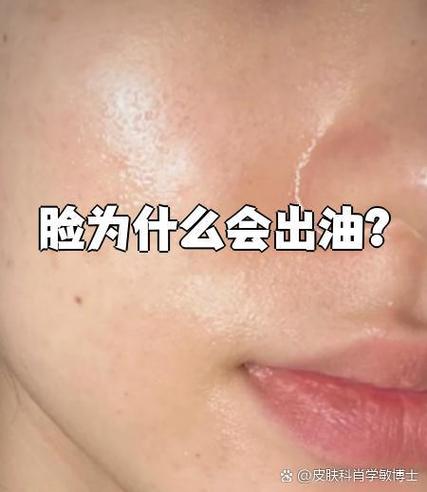 为什么脸上老是出油