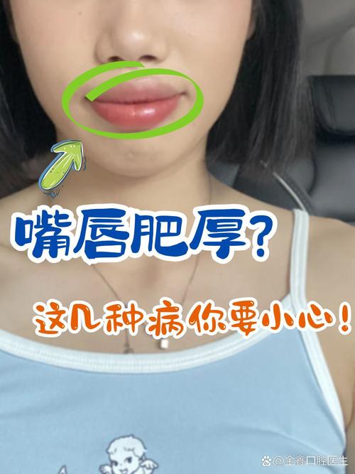 嘴唇厚是为什么