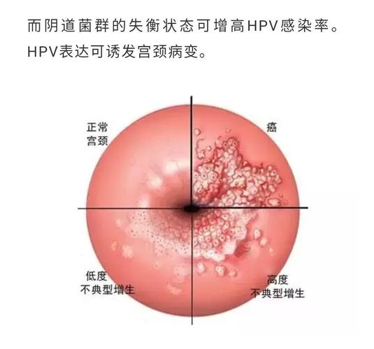 阴道什么样图片