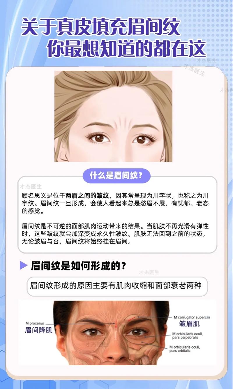 眉间纹代表什么