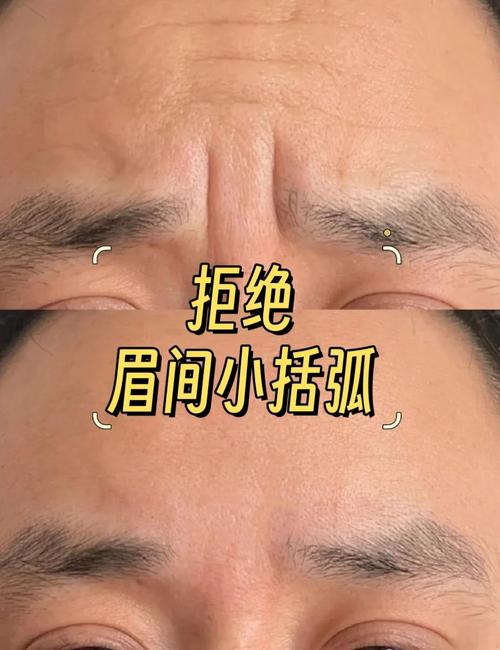 眉间纹代表什么