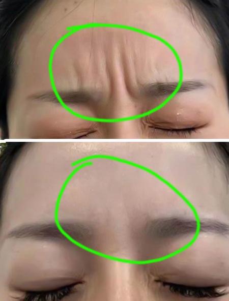 眉间纹代表什么
