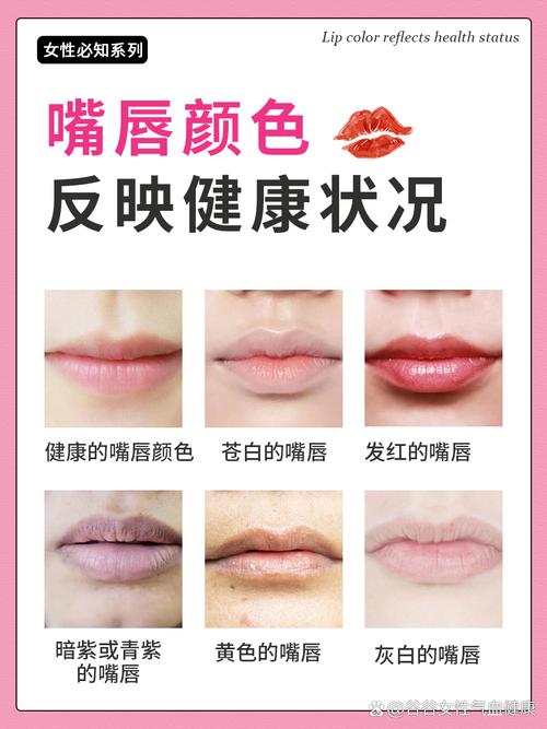 嘴唇的颜色代表什么