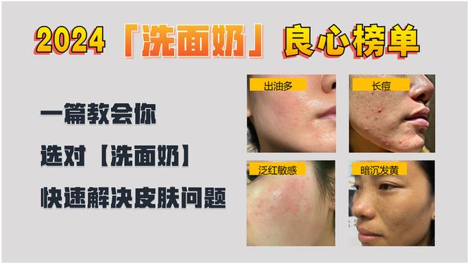 用了洗面奶长痘怎么办