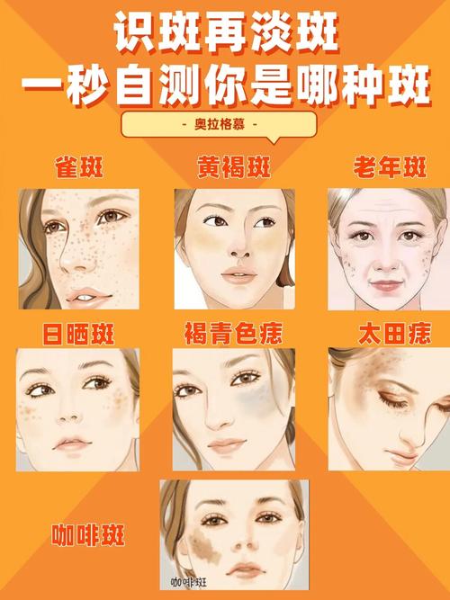 五什么斑什么