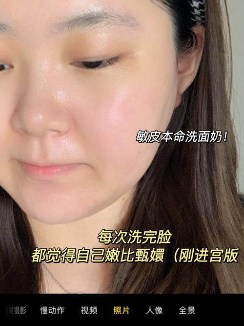 什么洗面奶会长痘痘怎么回事