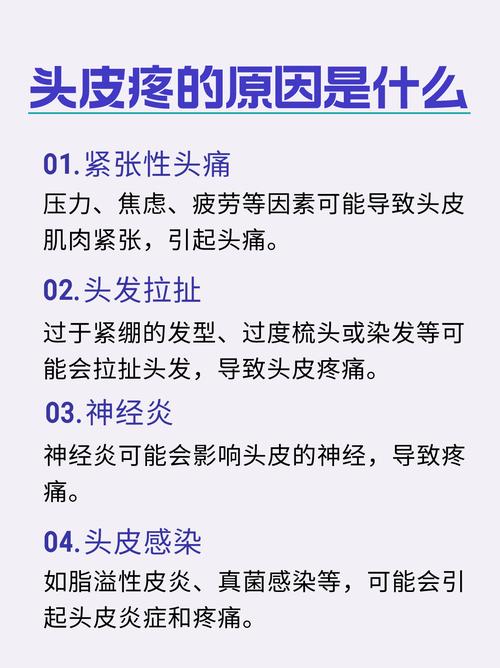 头顶头皮痛什么原因