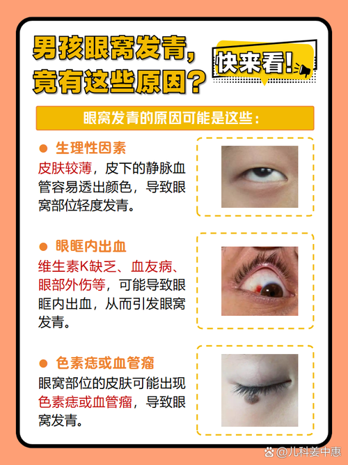 眼窝发青是什么原因