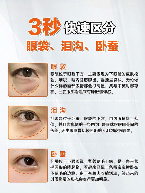 眼袋深是什么原因