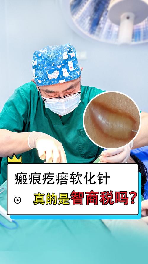 疤痕疙瘩打什么针