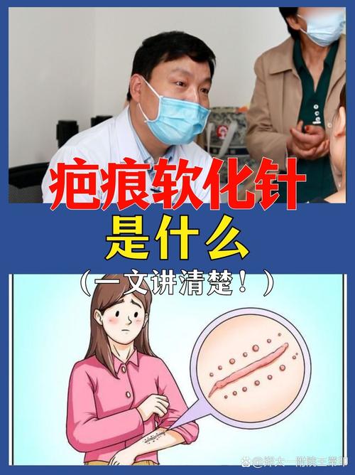 疤痕疙瘩打什么针