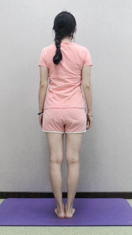 什么叫o型腿