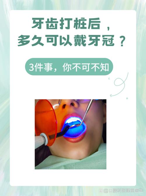 牙齿为什么要打桩