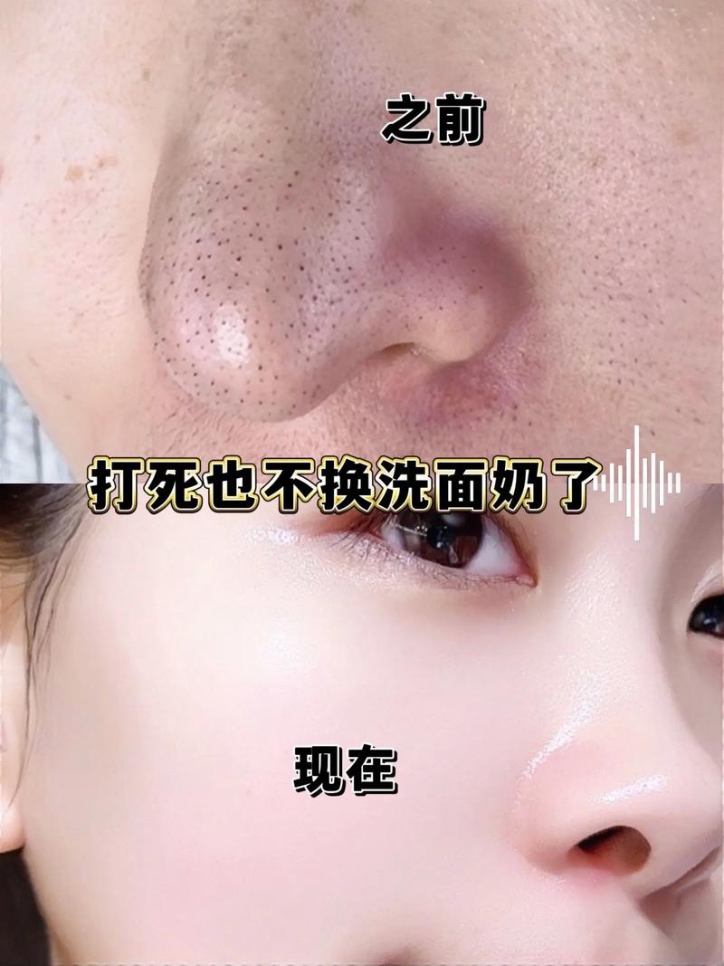 用了带颗粒的洗面奶皮肤变得很差该怎么办