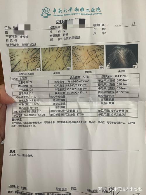 头发脱落看什么科