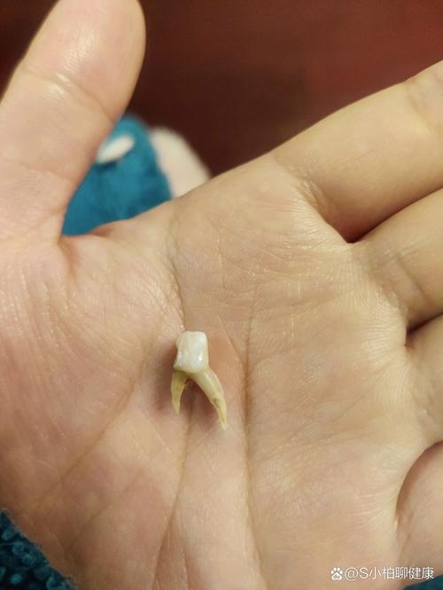 牙根在什么位置