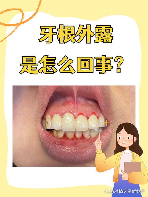 牙根在什么位置