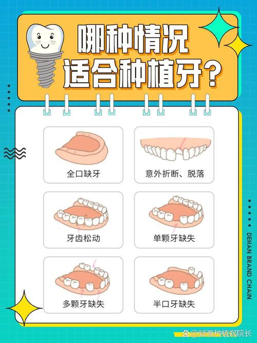 牙种植是什么