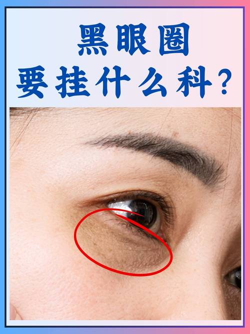 什么是黑眼圈什么是眼袋