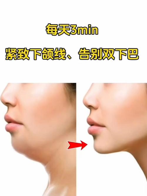 不胖为什么有双下巴