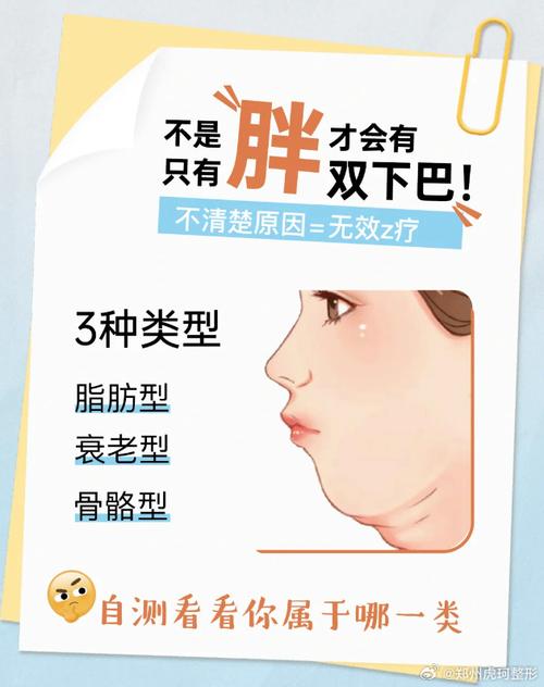 不胖为什么有双下巴