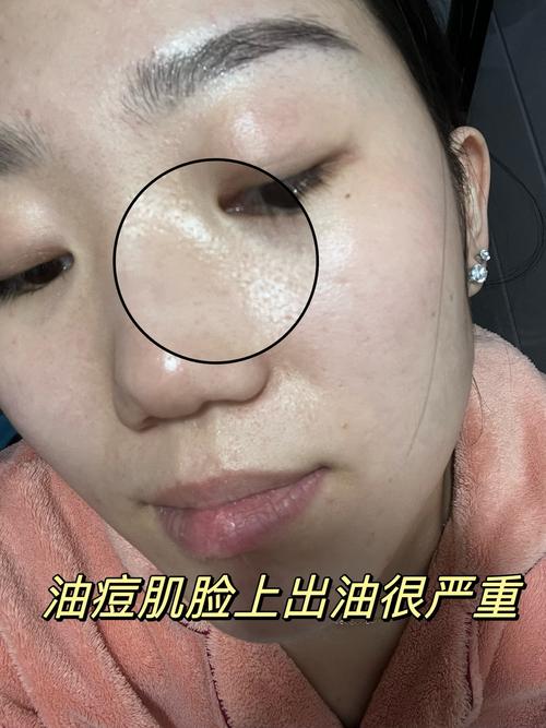 一个星期不用洗面奶会怎么样