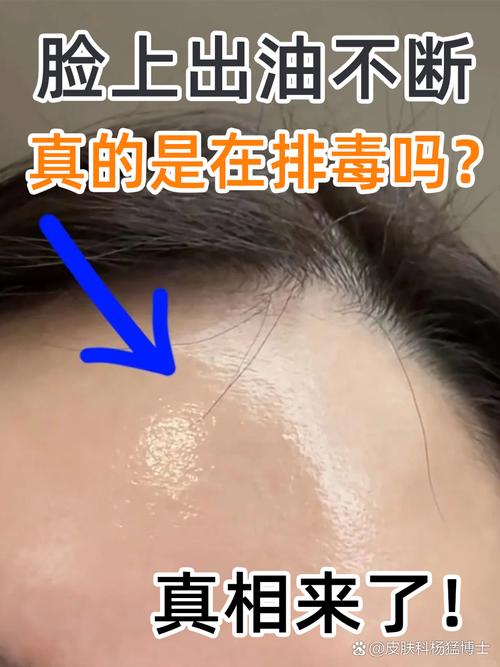 脸上有油是什么原因