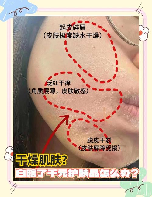 洗面奶洗过后紧绷好吗怎么办
