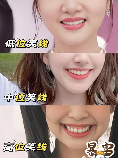 为什么牙齿会不整齐