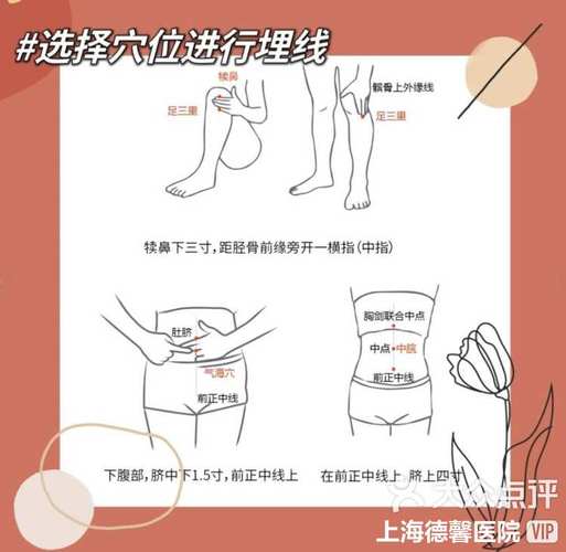 什么是中医埋线减肥
