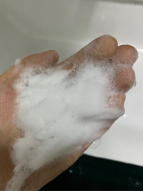 因为洗面奶发际线变高怎么办